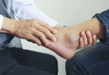 physiotherapy after ankle surgery