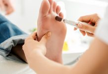 Get Tailor’s Bunion Treated in Singapore Podiatry Clinic!
