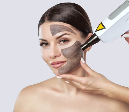 Skin Laser Treatment